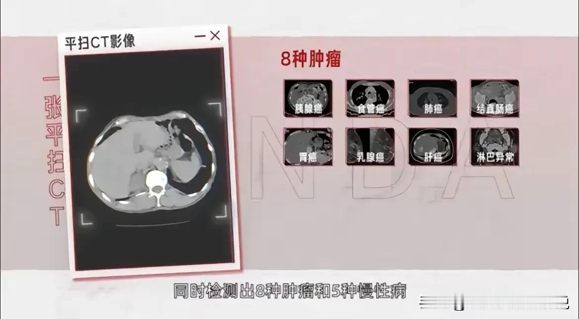 《阿里再登全球百强！开源AI霸主+抗癌黑科技